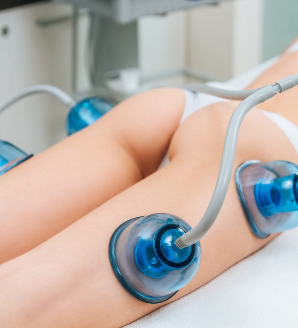 selective-focus-of-woman-with-cupping-cups-on-legs-and-buttocks-e1632845114946-pdsbwt15pplik1o1asw3z1c84hpdcz3al4s2z36cqg